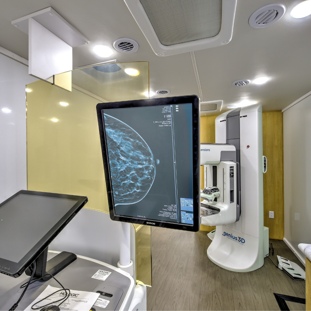 A ultrasound machine inside a mobile medical vehicle